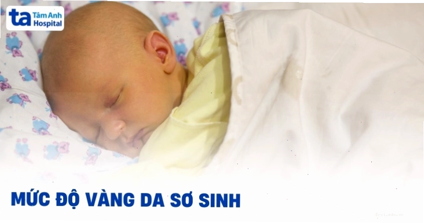 Các mức độ vàng da sơ sinh