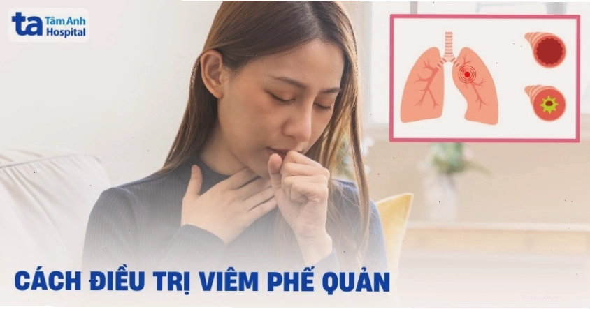 Các phương pháp điều trị viêm phế quản