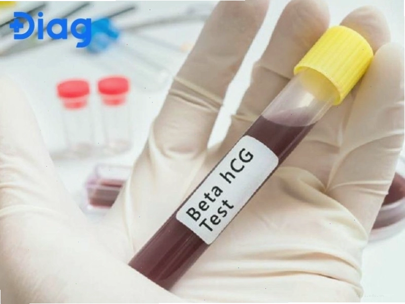 Chỉ một tinh trùng có thể kết hợp với trứng để tạo thành hợp tử