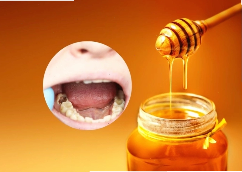 Hình ảnh minh họa về các đối tượng không nên dùng mật ong