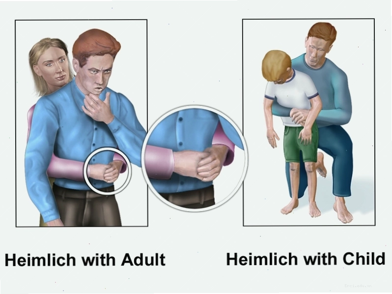 Kỹ thuật ép bụng vỗ lưng hỗ trợ đẩy xương cá
