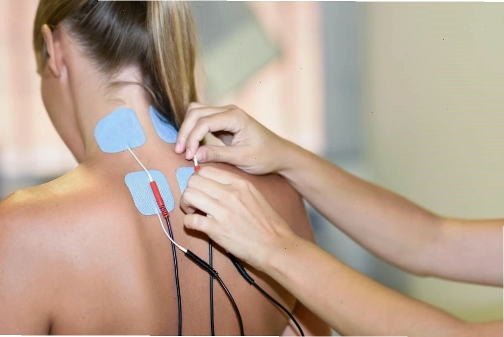 Liệu pháp châm cứu có thể được áp dụng để điều trị vẹo cổ