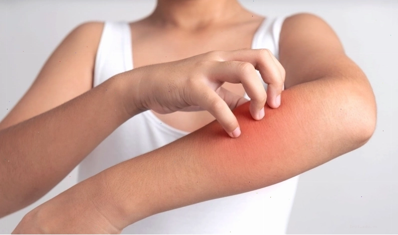 Lời khuyên về việc ăn lòng trắng trứng gà an toàn