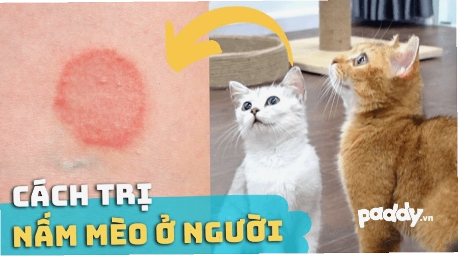 Minh họa tình trạng nấm mèo ở người với các mảng đỏ trên da