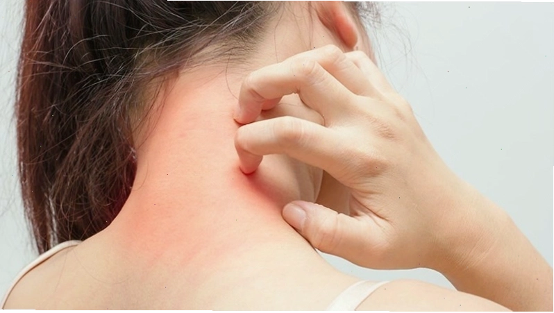 Một số ít người có thể bị dị ứng với quế