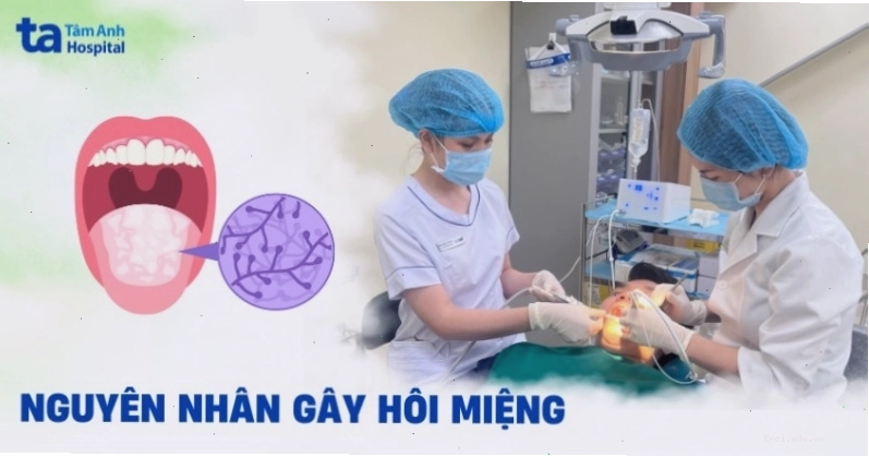 Nhiều nguyên nhân khác nhau có thể dẫn đến tình trạng hôi miệng khó chịu