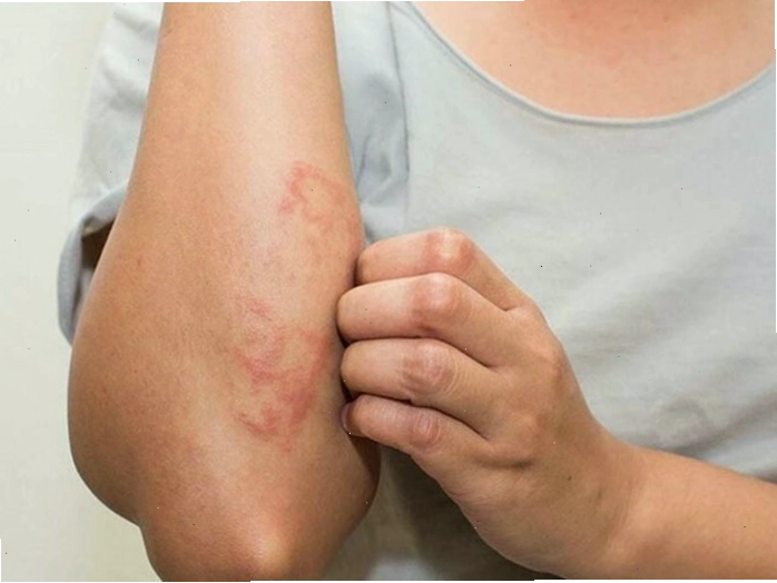 Nước ô nhiễm gây hại cho da, gây kích ứng và khô da