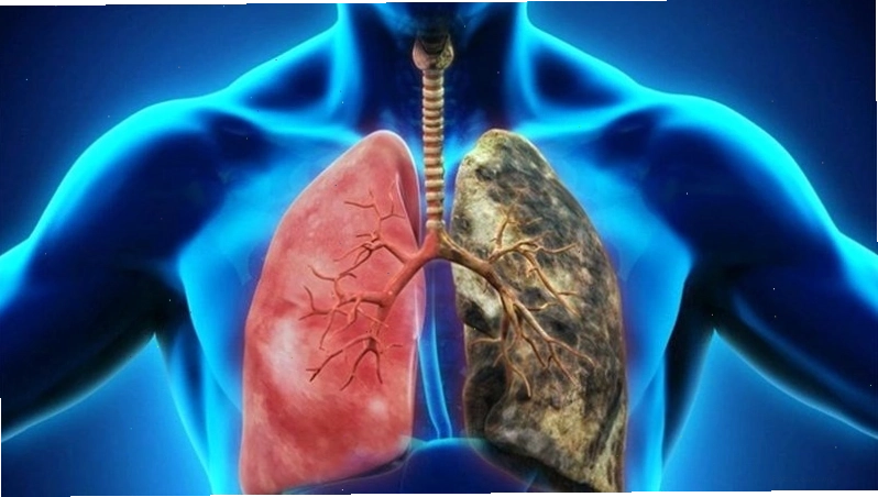 Ô nhiễm môi trường là nguyên nhân tiềm ẩn gây ung thư phổi