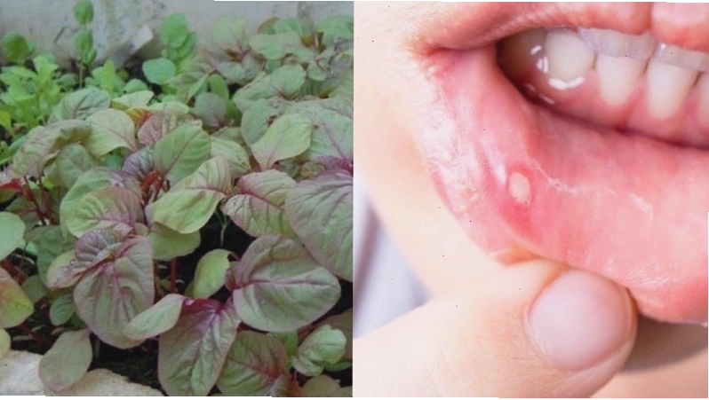Rau dền giúp ngăn ngừa các vấn đề về răng miệng
