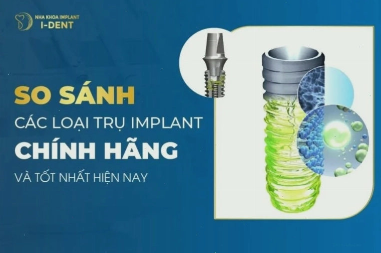 So sánh các loại trụ implant chính hãng và chất lượng cao