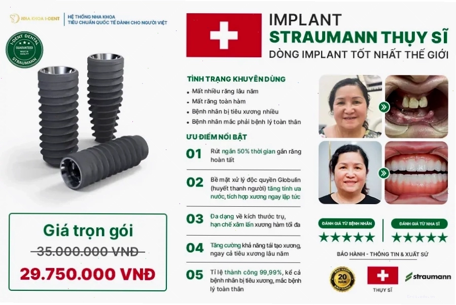 So sánh các loại trụ implant dựa trên chất liệu và thiết kế bề mặt
