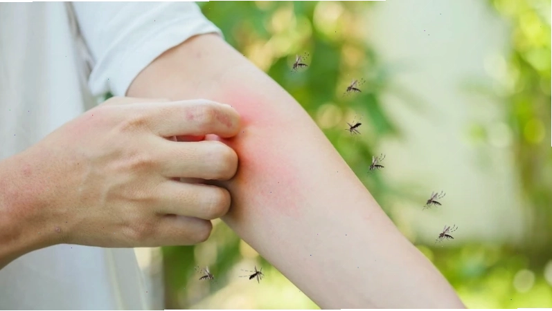 Sử dụng lưới chống muỗi để bảo vệ gia đình