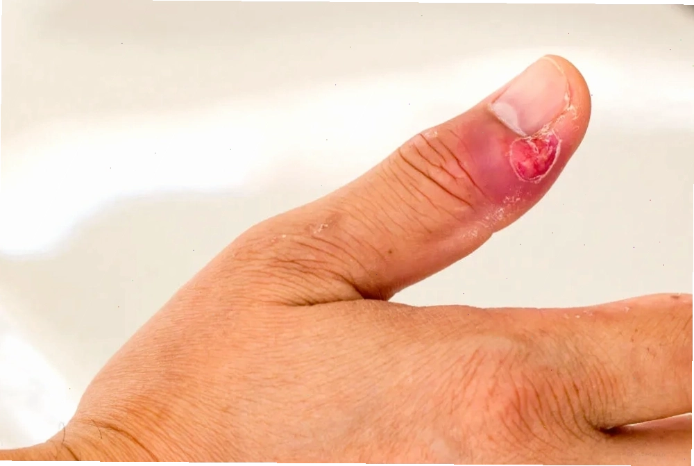 Trẻ cắn móng tay có thể gặp vấn đề về tâm lý và sự tự tin
