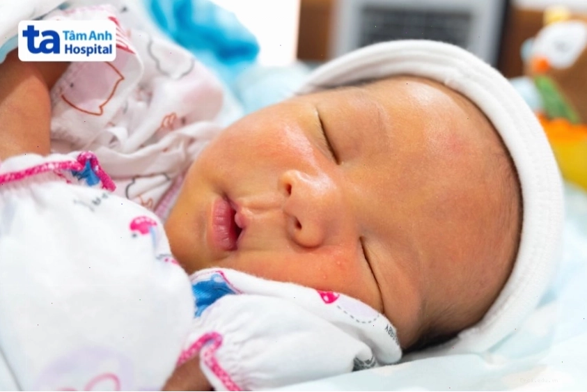 Trẻ sơ sinh bị vàng da với da và niêm mạc chuyển màu vàng