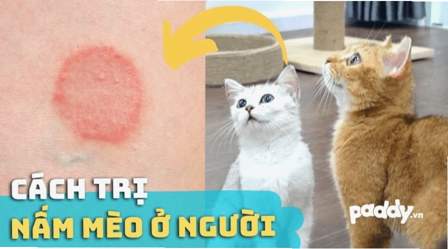 Vết nấm mèo ở người với vùng da đỏ và bong tróc