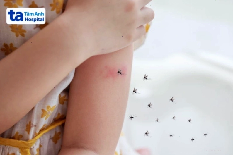 Virus Dengue gây ra bệnh sốt xuất huyết