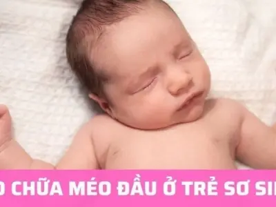 Bật mí mẹo dân gian chữa méo đầu cho trẻ sơ sinh an toàn
