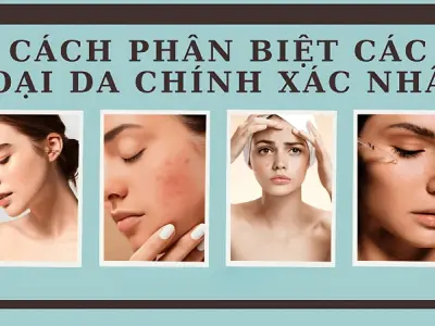 Cách phân biệt loại da chính xác để chăm sóc hiệu quả