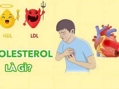 Cholesterol là gì? Cách hiểu đúng và phòng bệnh sớm