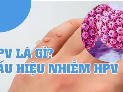 HPV là gì? Tác hại của virus HPV với nam và nữ giới