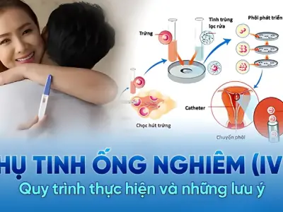 Làm IVF là gì? Những điều cần biết trước khi bắt đầu