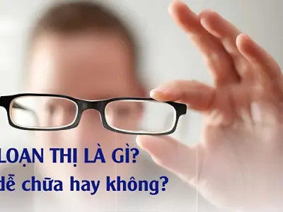 Loạn thị là gì? Hiểu rõ về tình trạng mắt phổ biến hiện nay