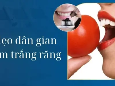 Không thể tin mẹo dân gian làm trắng răng lại dễ đến vậy