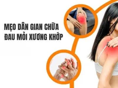 Đừng bỏ lỡ mẹo dân gian chữa xương khớp lưu truyền lâu đời