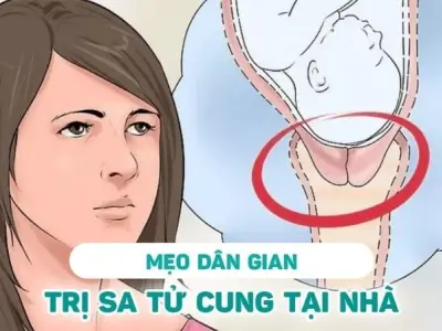 Bài thuốc dân gian trị sa tử cung được lưu truyền rộng rãi
