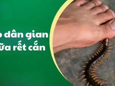 Hé lộ mẹo dân gian chữa rết cắn từ kinh nghiệm xưa