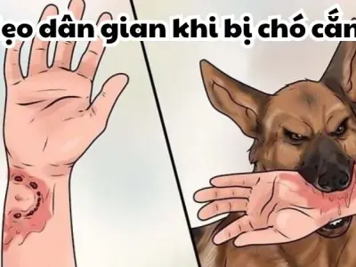 Chuyên gia mách mẹo dân gian khi bị chó cắn cấp tốc