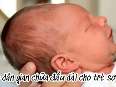 Mẹo dân gian chữa đầu dài cho trẻ sơ sinh an toàn hiệu quả