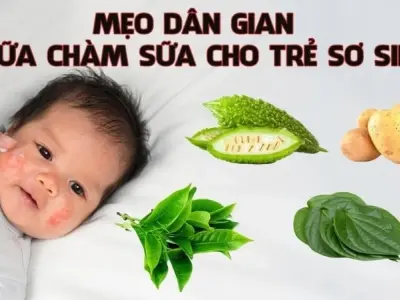 Hé lộ mẹo dân gian trị chàm sữa cho trẻ sơ sinh hiệu quả