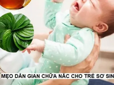 Mẹo dân gian chữa nấc cho trẻ sơ sinh hiệu quả tức thì