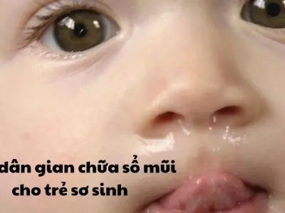 Mẹo dân gian chữa sổ mũi cho trẻ sơ sinh cực dễ làm