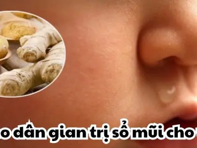 Áp dụng ngay mẹo dân gian trị sổ mũi cho trẻ nhỏ an toàn