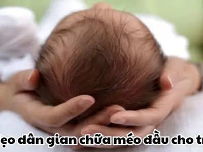 Mẹo dân gian chữa méo đầu cho trẻ được tin dùng từ xưa