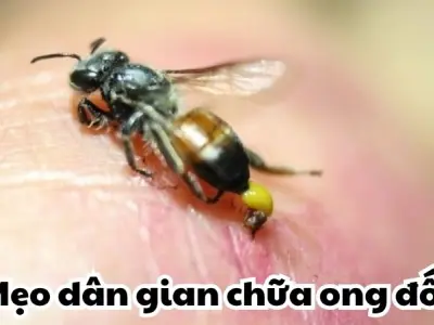 Học ngay mẹo dân gian chữa ong đốt không để lại sẹo