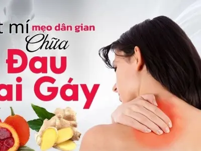 Cách áp dụng mẹo dân gian chữa đau vai gáy đúng cách