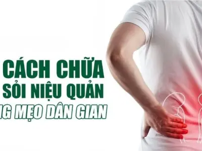 Hướng dẫn chữa sỏi niệu quản bằng mẹo dân gian an toàn