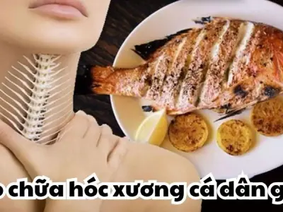 Bật mí mẹo chữa hóc xương cá dân gian hiệu quả bất ngờ