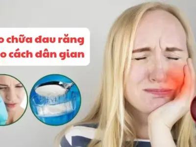 Học ngay mẹo chữa đau răng dân gian giảm đau tức thì
