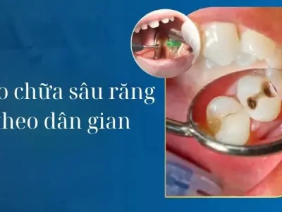 Những mẹo chữa sâu răng dân gian người xưa truyền lại