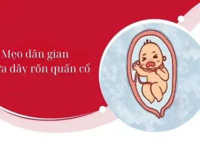Giải mã mẹo dân gian chữa dây rốn quấn cổ ít ai ngờ tới