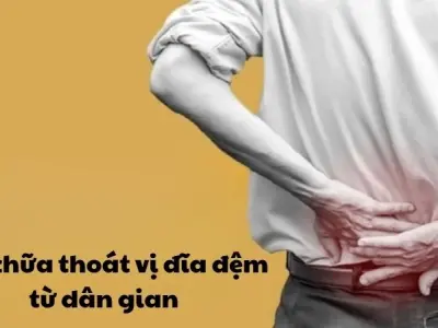 Giật mình với mẹo dân gian chữa thoát vị đĩa đệm hiệu quả