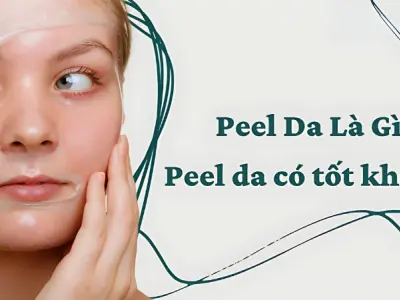 Peel da là gì? Tìm hiểu bí quyết tái tạo làn da sáng khỏe