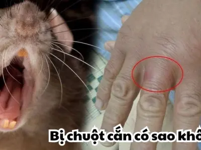 Bị chuột cắn có sao không - Đừng xem thường vết xước nhỏ