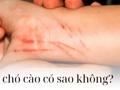 Bị chó cào có sao không - Tìm hiểu ngay để tránh biến chứng