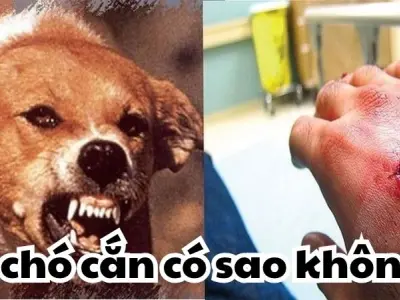 Giải mã việc bị chó cắn có sao không từ chuyên gia