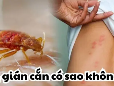 Gián cắn có sao không - Cẩn trọng hiểm họa trong bóng tối